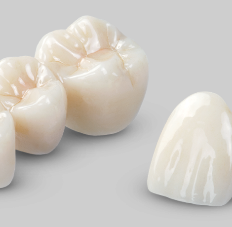 Full Ceramic Crowns