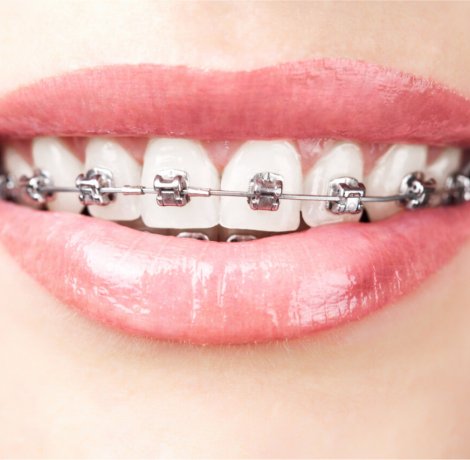 Orthodontics