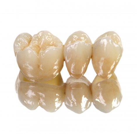 Zirconia Crowns